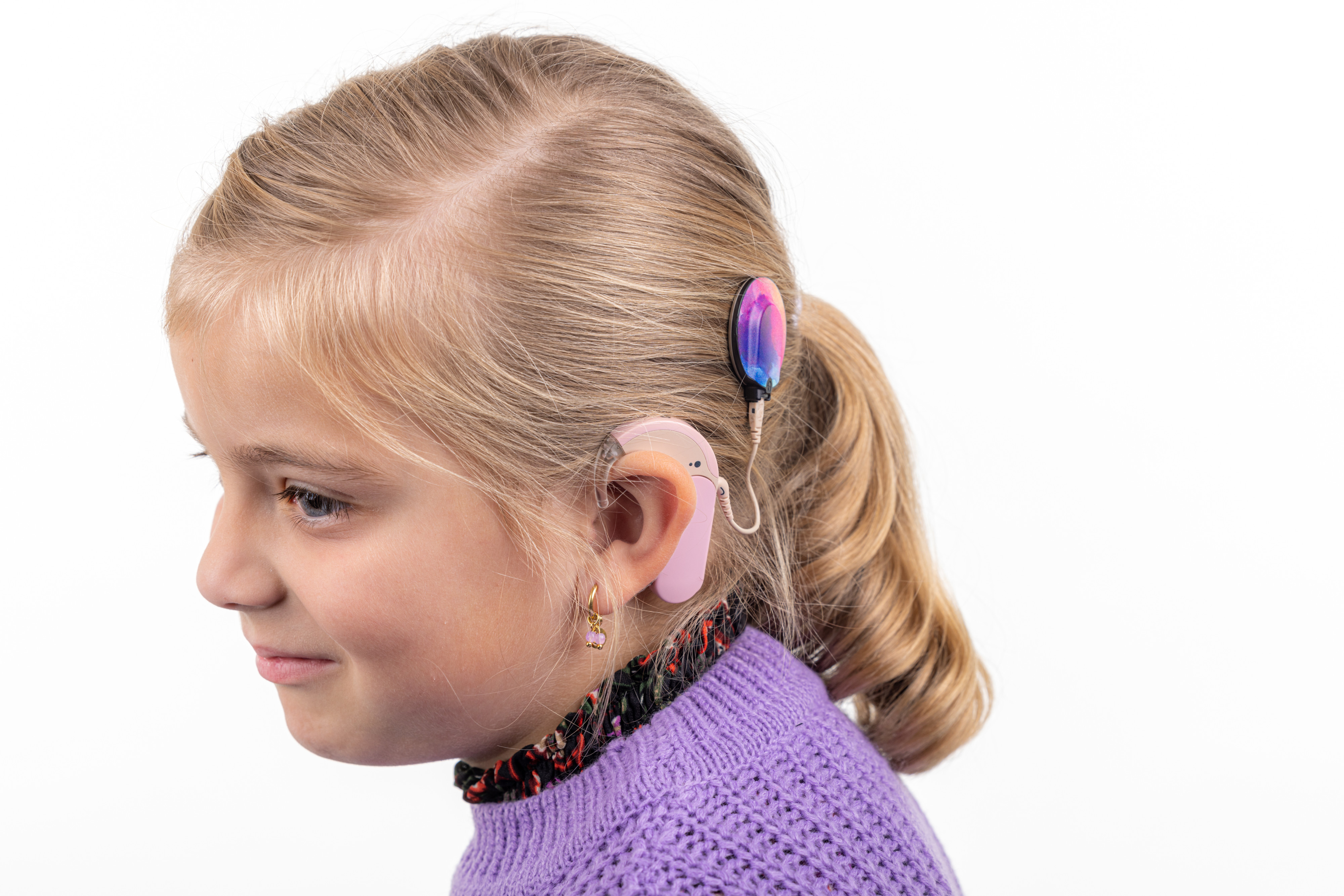 Cochleair implantaat kinderen